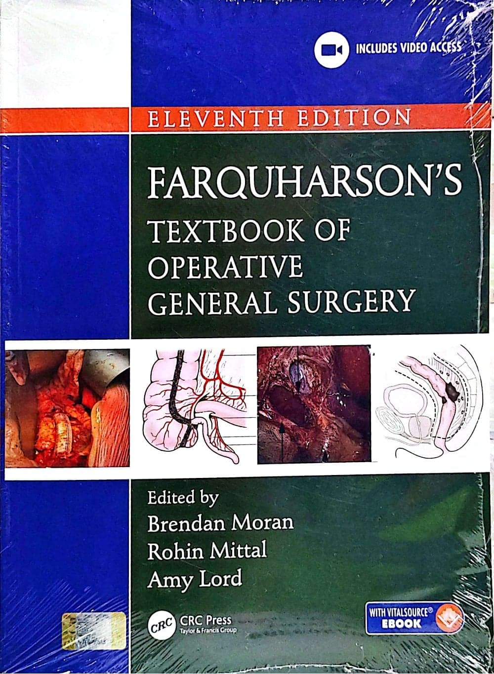 FARQUHARSONS TEXTBOOK OF OPERATIVE GENERAL SURGERY